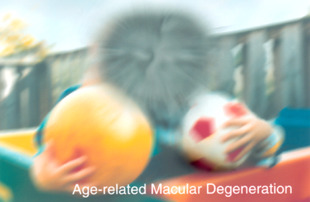 seeing with age-related macular degeneration
