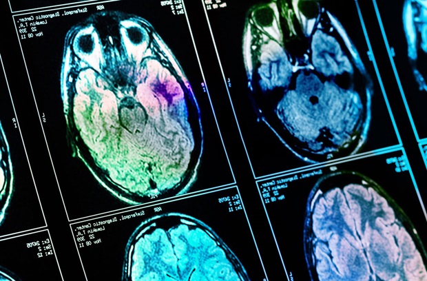 Brain scans on lightboard