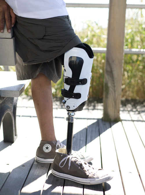 How I Don And Doff My Above Knee Prosthetic Leg 