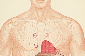 animated male chest demonstrating auscultation points for diagnosis