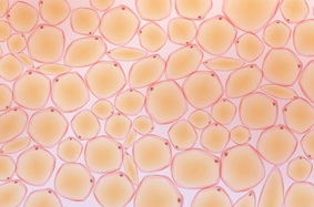 Fat tissue showing cells