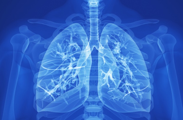 Stock photo of lung x-ray