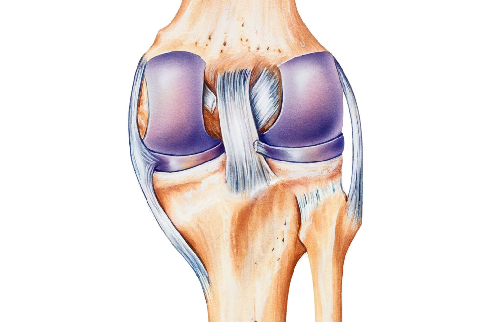 MCL Tear - Relieve Foot Pain & Leg Pain
