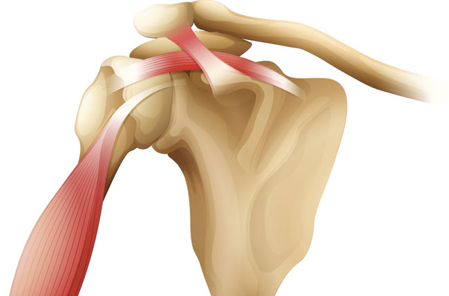 https://www.pennmedicine.org/-/media/images/medical%20and%20research%20images/anatomy/rotator_cuff_1.ashx