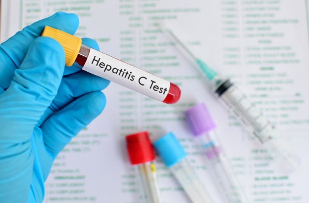 blood sample for hepatitis c lab test