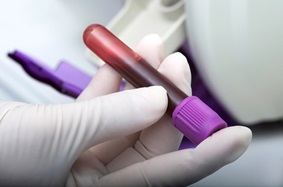 Stock photo of lab technician or doctor holding blood sample 