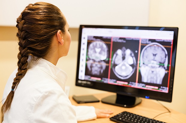 doctor looking at brain tumor scan