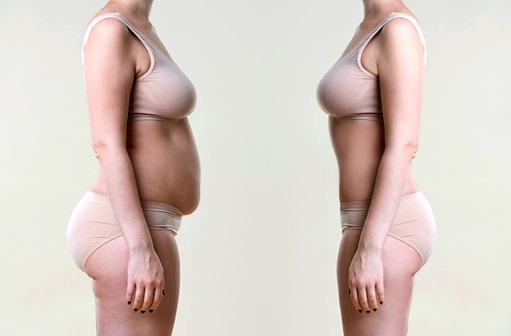 Female body in underwear before and after weight loss
