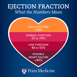 Ejection fraction graphic