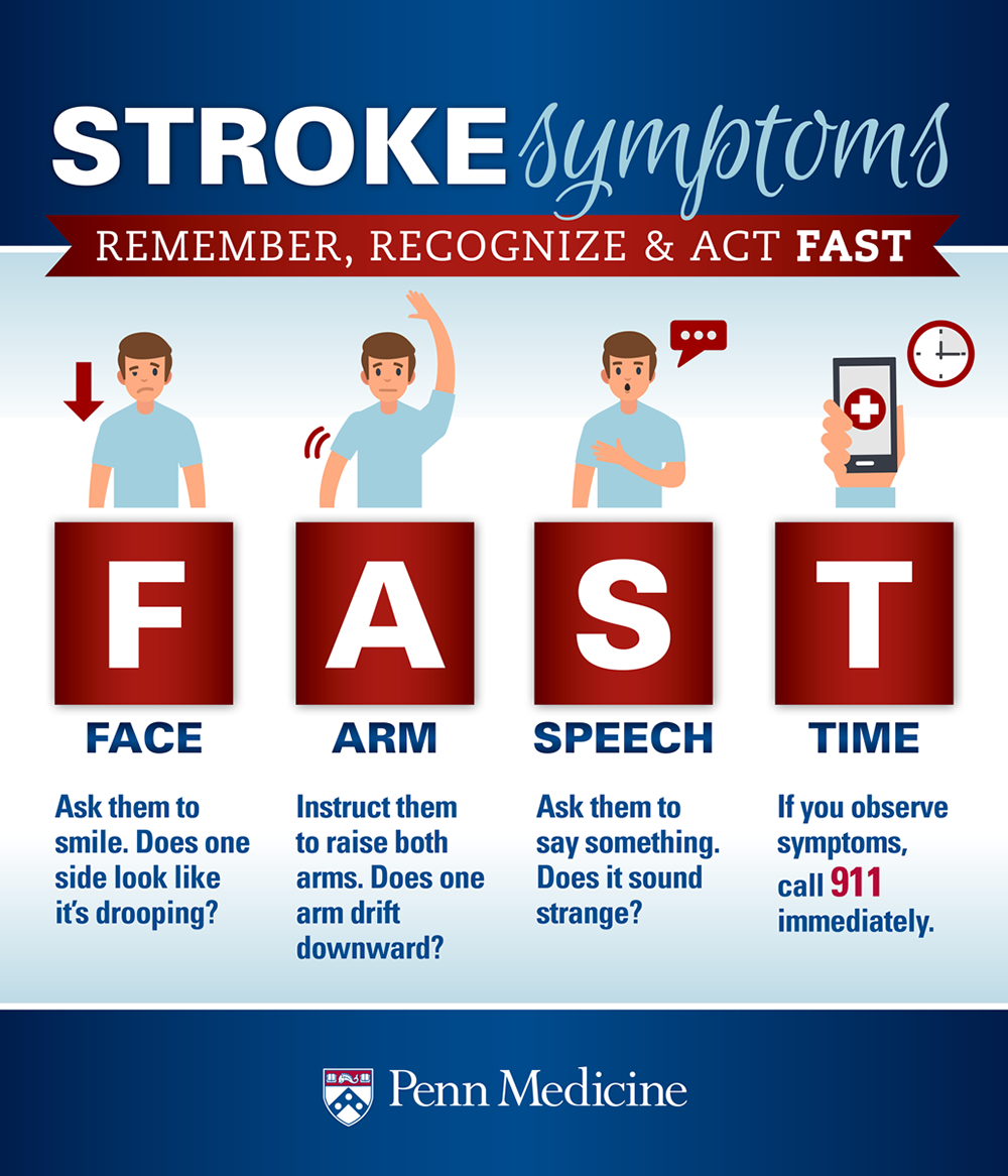 FAST stroke symptoms