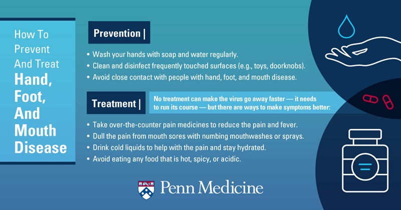 infographic_explains_how_to_prevent_and_treat_hand_foot_and_mouth_disease_wash_hands_clean_and_disinfect_surfaces_avoid_contact_with_contaminated_people_take_medicine_use_mouthwash_and_sprays_drink_cold_fluids_avoid_spicy_foods