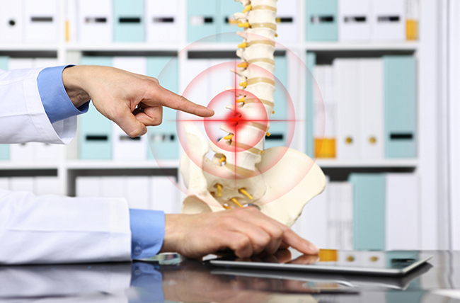 A Herniated Disc Could Be The Reason if Your Back is Hurting