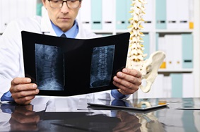 doctor looking at spine xray