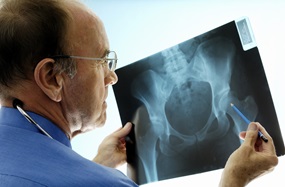A male doctor examines a hip x-ray.