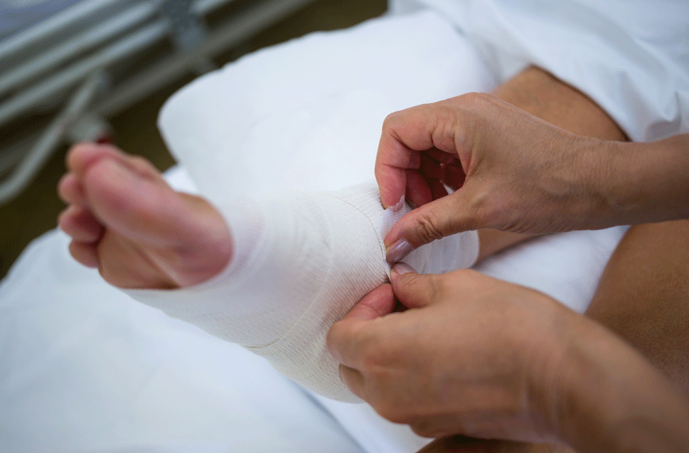 Foot and ankle recovery: What to expect