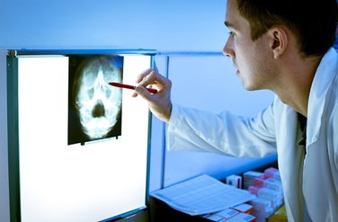 doctor reviewing cancer xray