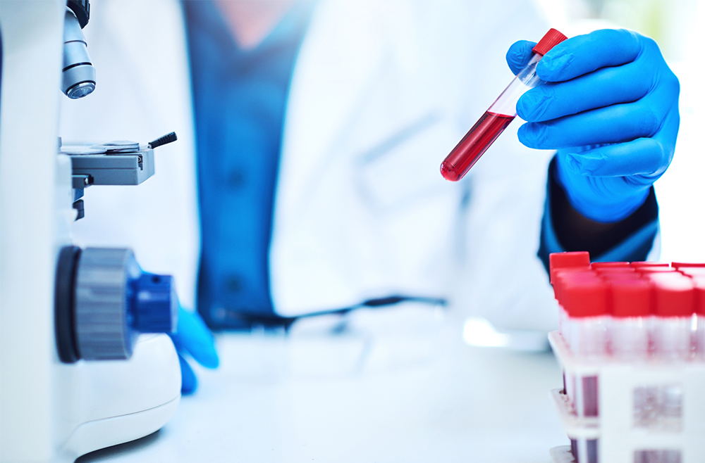 Blood Test May Help Doctors Catch Pancreatic Cancer Early - Penn